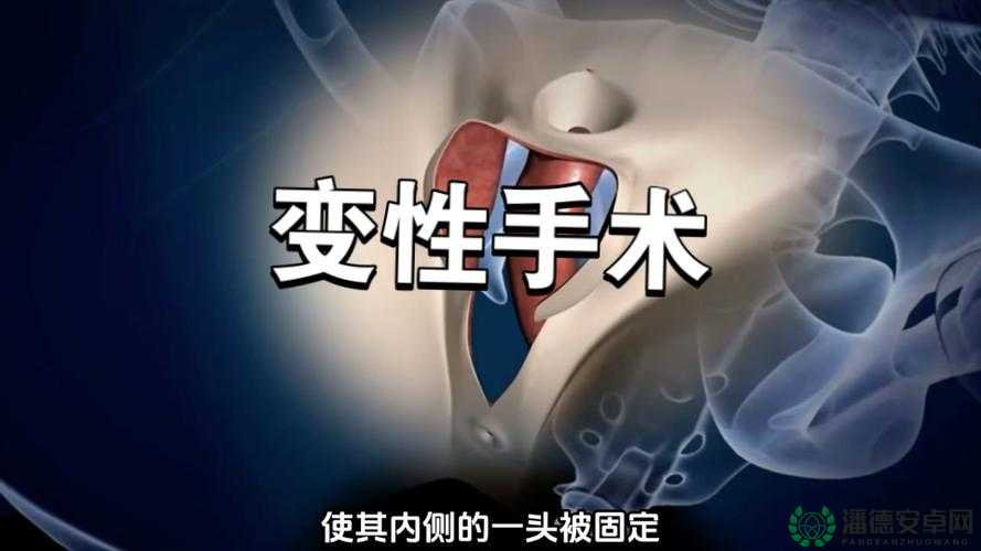变性人 XXXHD 的独特人生经历与故事探讨